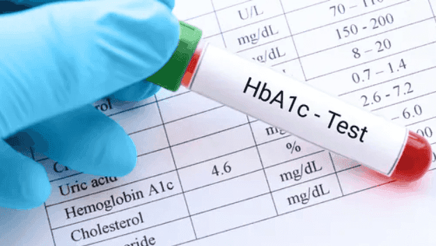 HbA1c Test