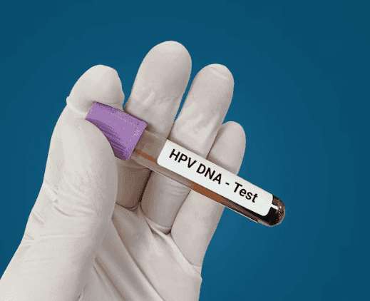 HPV DNA Test
